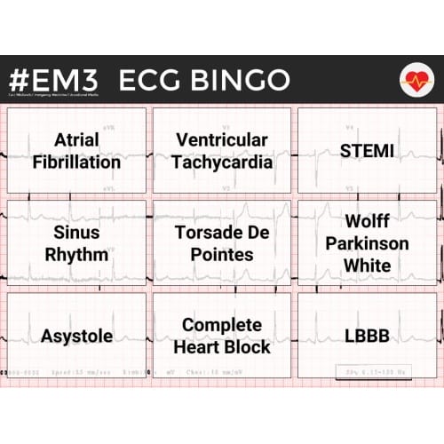 ECG Bingo